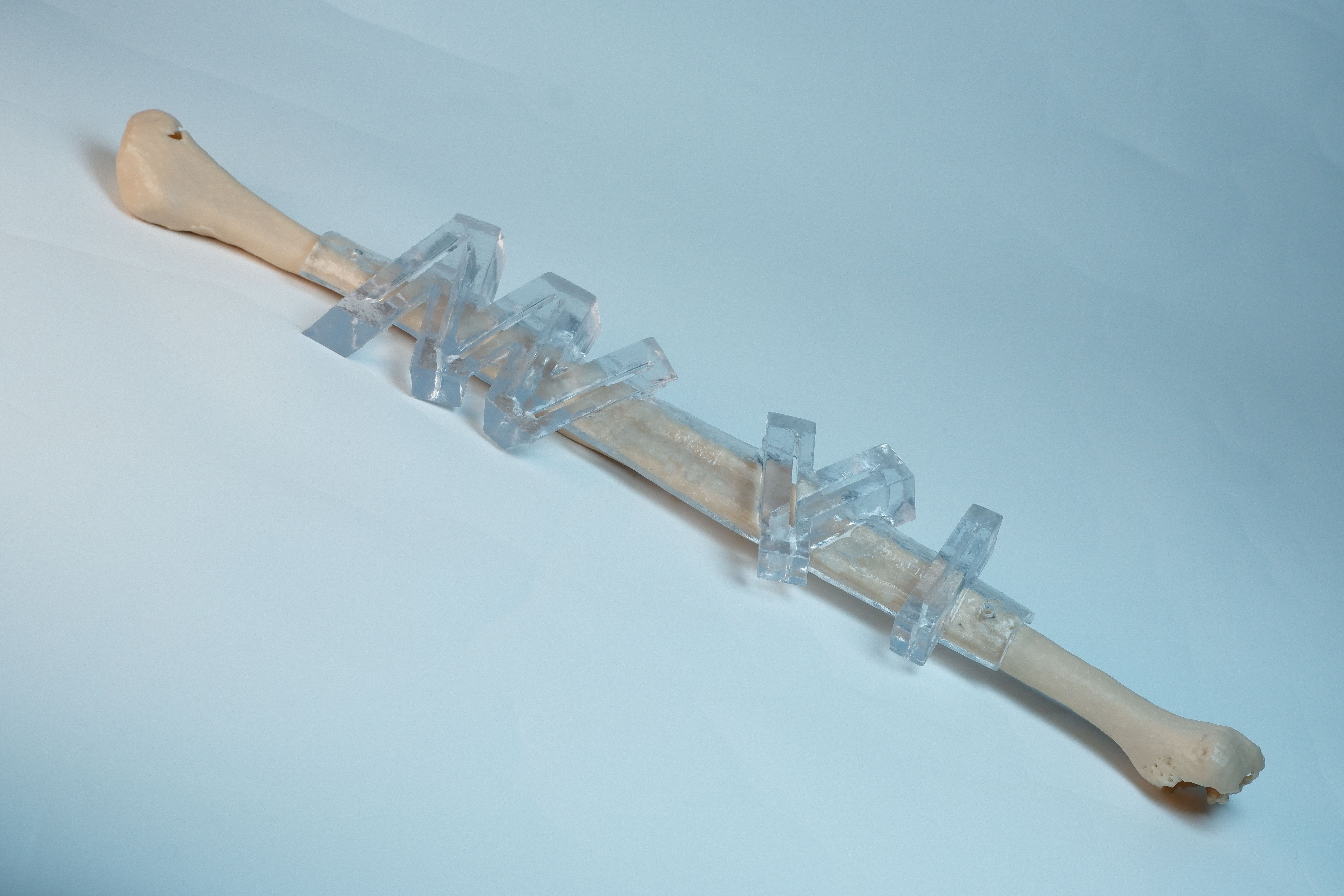 OsseoLabs: Fibular cutting guide