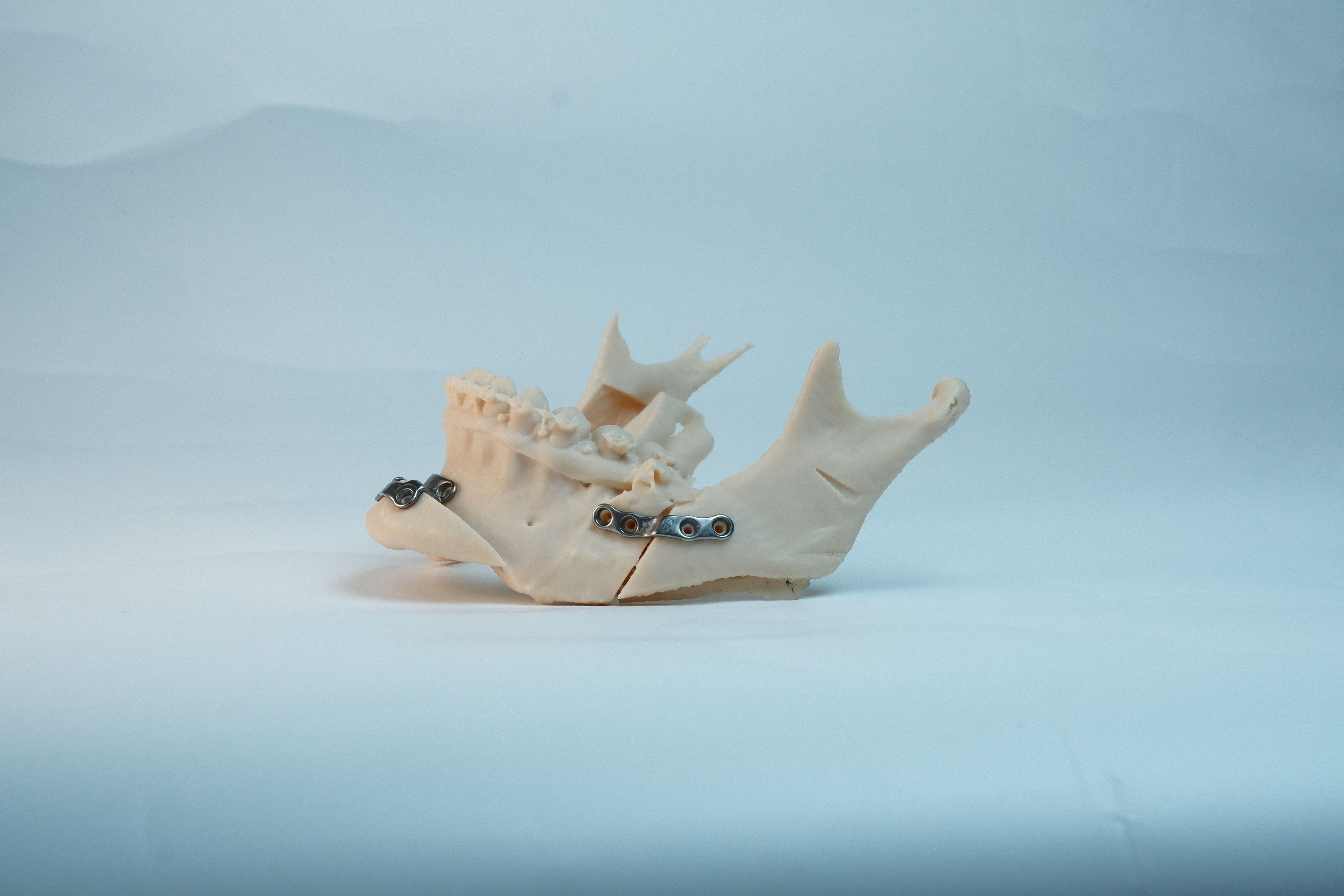 OsseoLabs: Fixation plate
