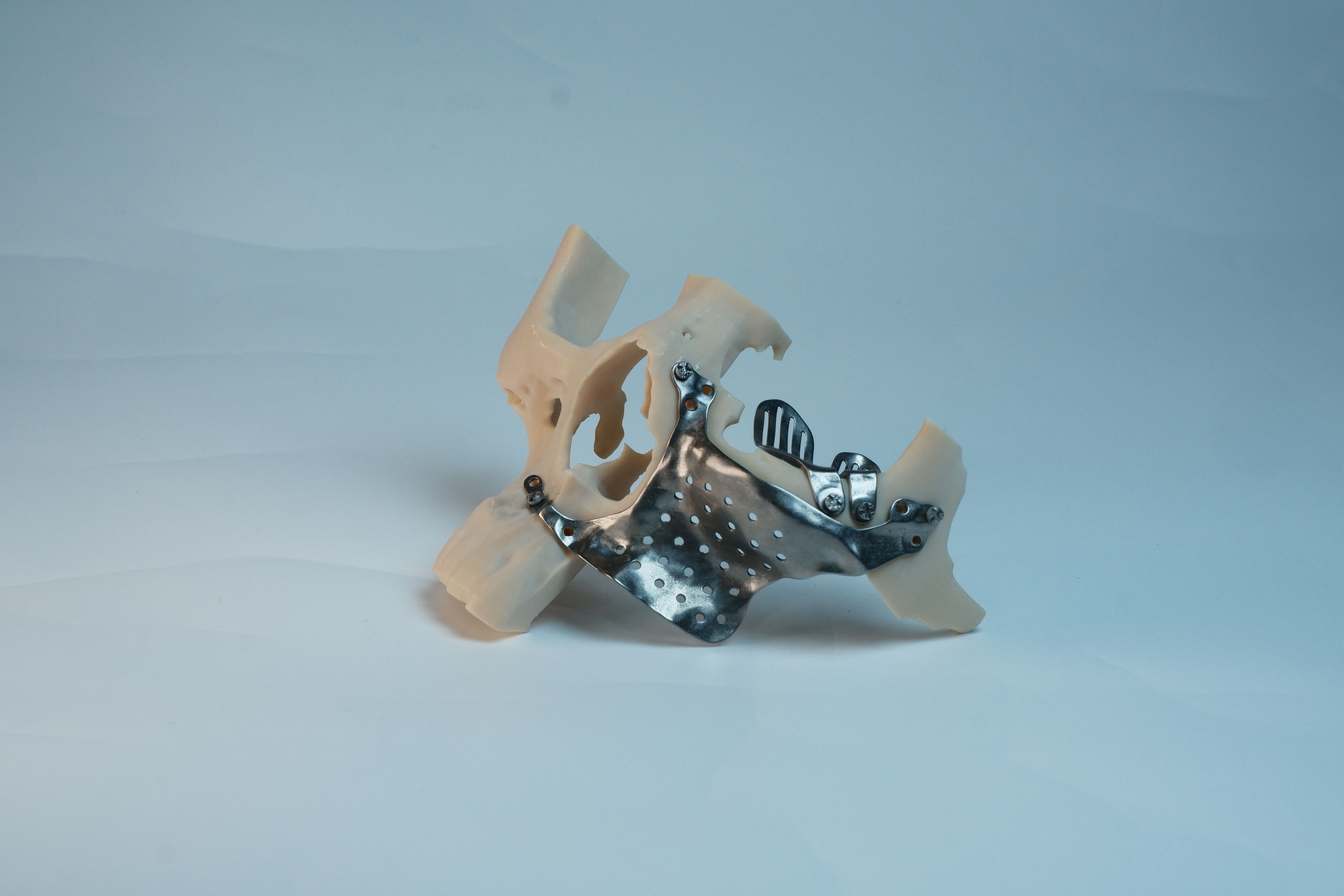 OsseoLabs: Maxilla plate